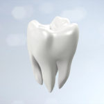 レーザー治療で虫歯が治る？